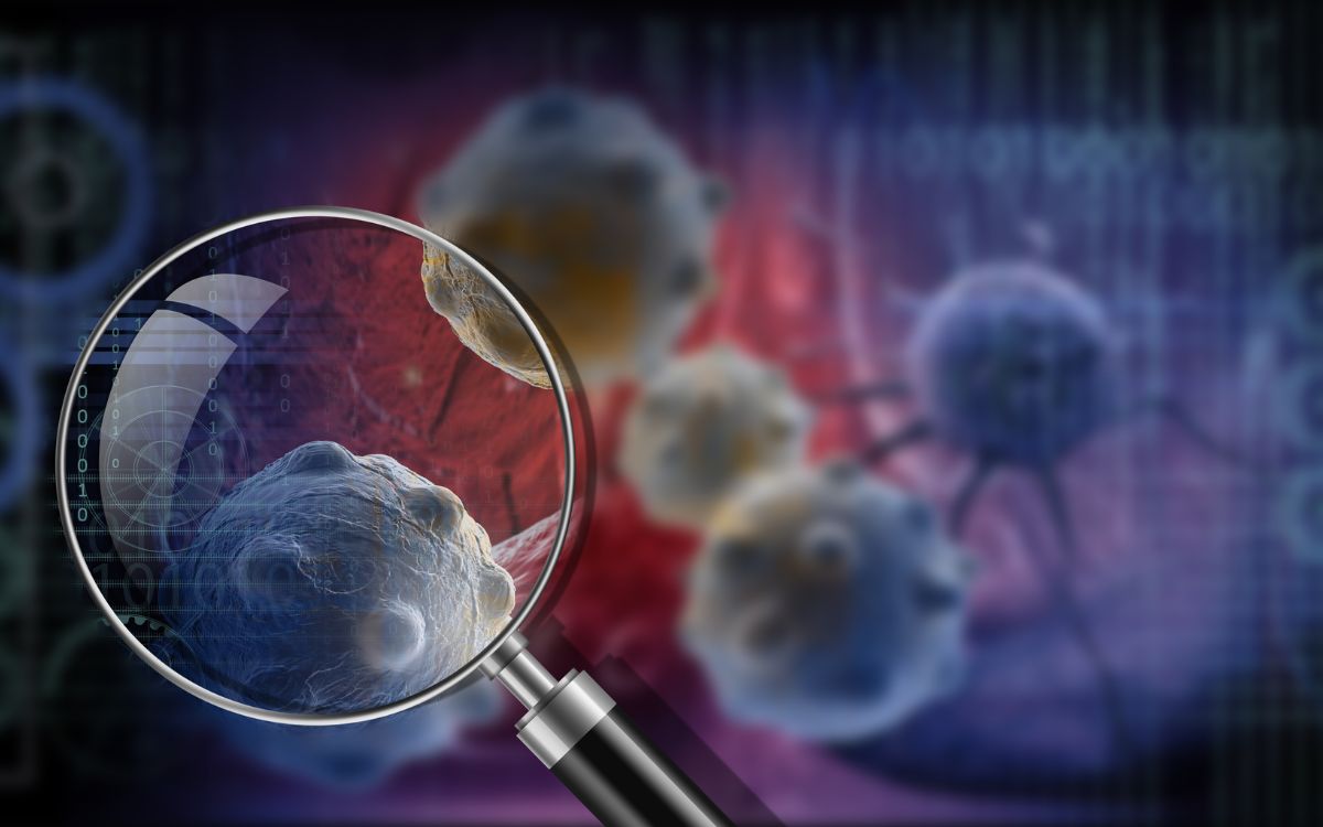 Principales tipos de cáncer